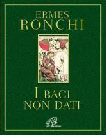BACI NON DATI